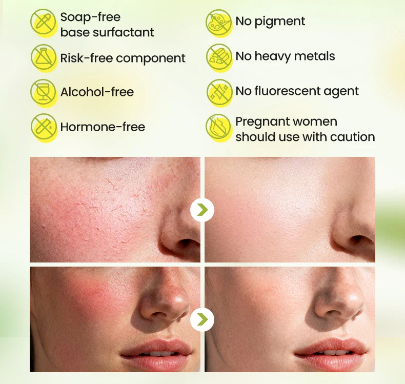 Icesea Australia Chamomile Facial Skin Care Set for Sensitive Skin-Moisturizer Soothing Redness & Dryness Relief(pic9)