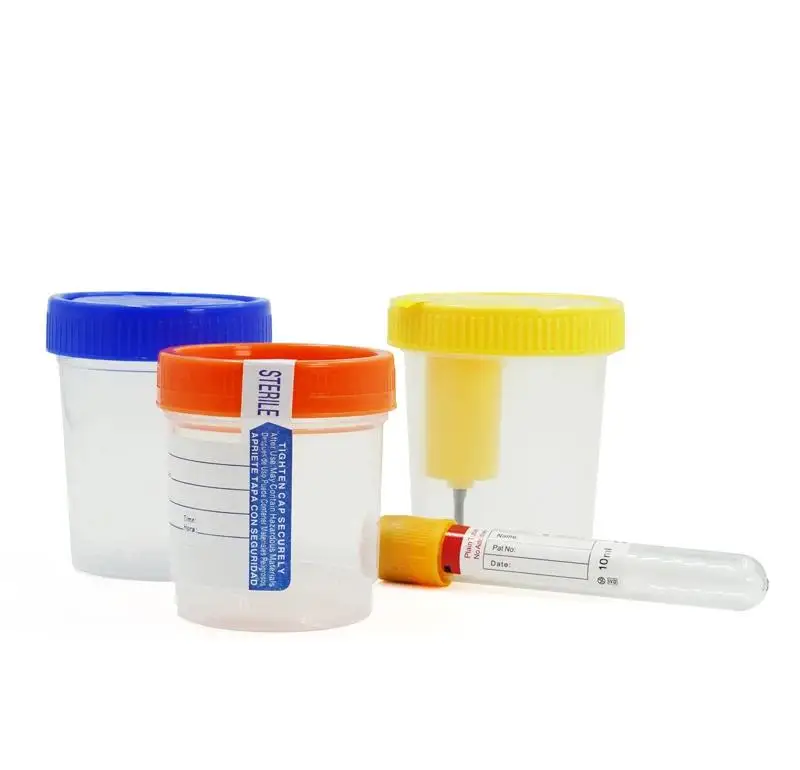Sterile PP Vacuum Urine Sample Collection Cup Customizable OEM Medical Urine Specimen Container for Hospital & Laboratory Use