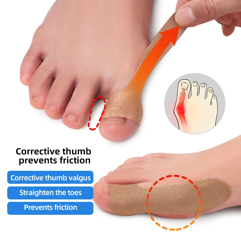 Thumb Fixator Tenosynovitis Big Toe Valgus Joint Fixator