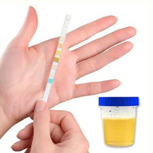 Urine Test  Strips Urine Creatinine and  Microalbumin test Strip