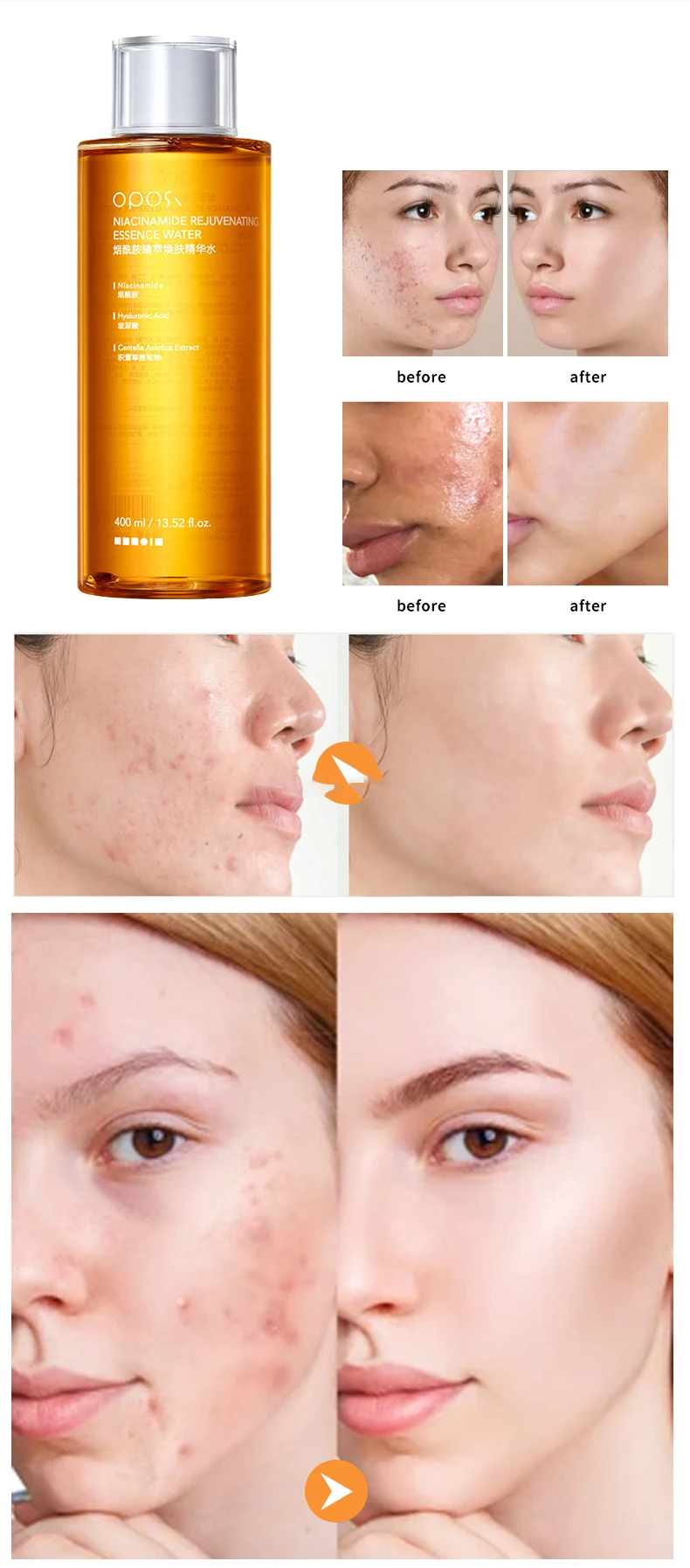 400ml Natural Organic Niacinamide Whitening Toner Refershing