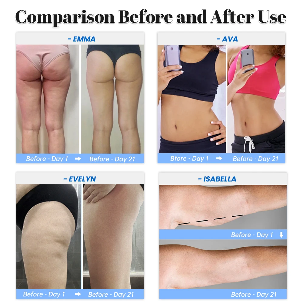 Home Use Anti Fat Treatment Machine G5 Vacuum Roller Electric Deep Tissue Massager Cellulite Remover