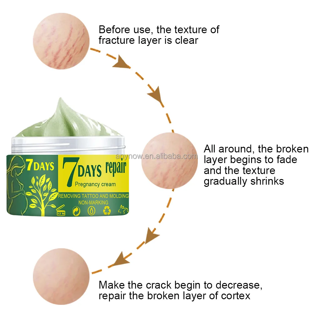  Stretch Marks Cream (6).jpg
