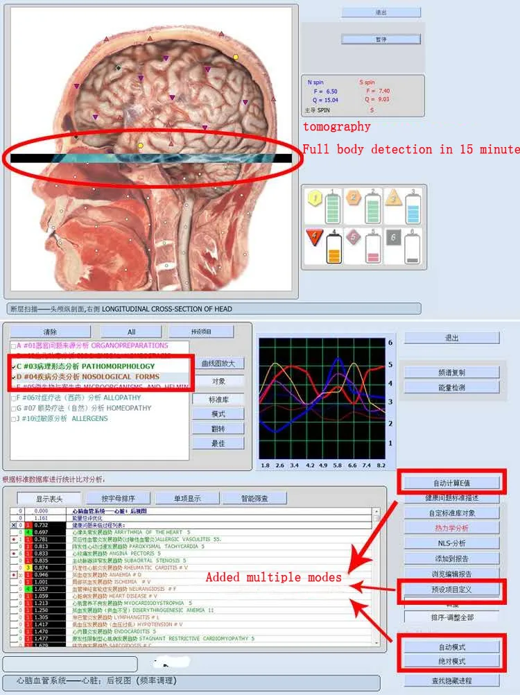 Portable USB DIZI A-200A 9D Detector NLSERA Health Management System 18D NLS Body Sub-health Organ Cell Cardiovascular Analyzer