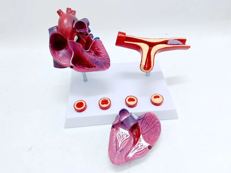 Human Anatomy Heart Model Coronary Artery Bypass And Vascular