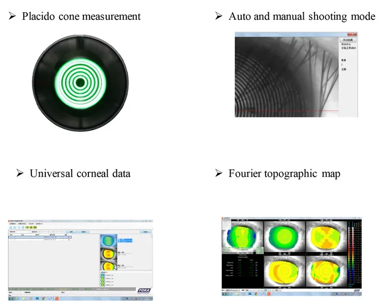 My-V056A Medical Optical Instrument Ophthalmic Corneal Topography Equipment, Corneal Topographer