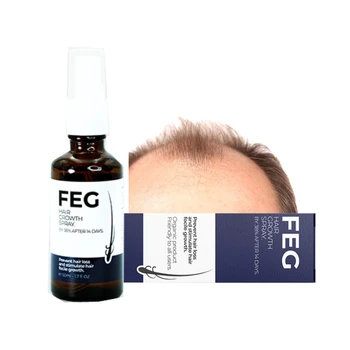Private Label OEM Aloe Vera Hair FEG Growth Oil for Adults Rapid Hair Growth Natural Hair Product
