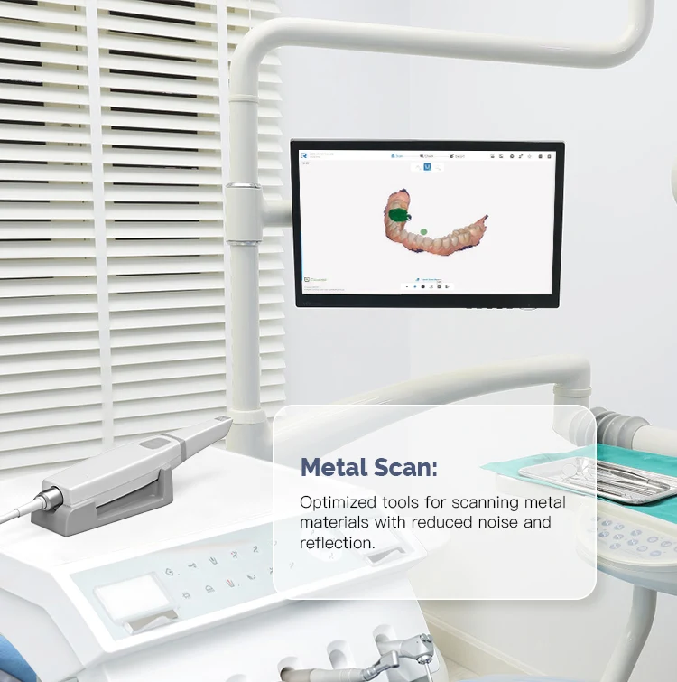 Long Lasting Azdent Dental Intraoral 3D Scanner with Software Real Dental Smart Intraoral Scanner Dental Scanner