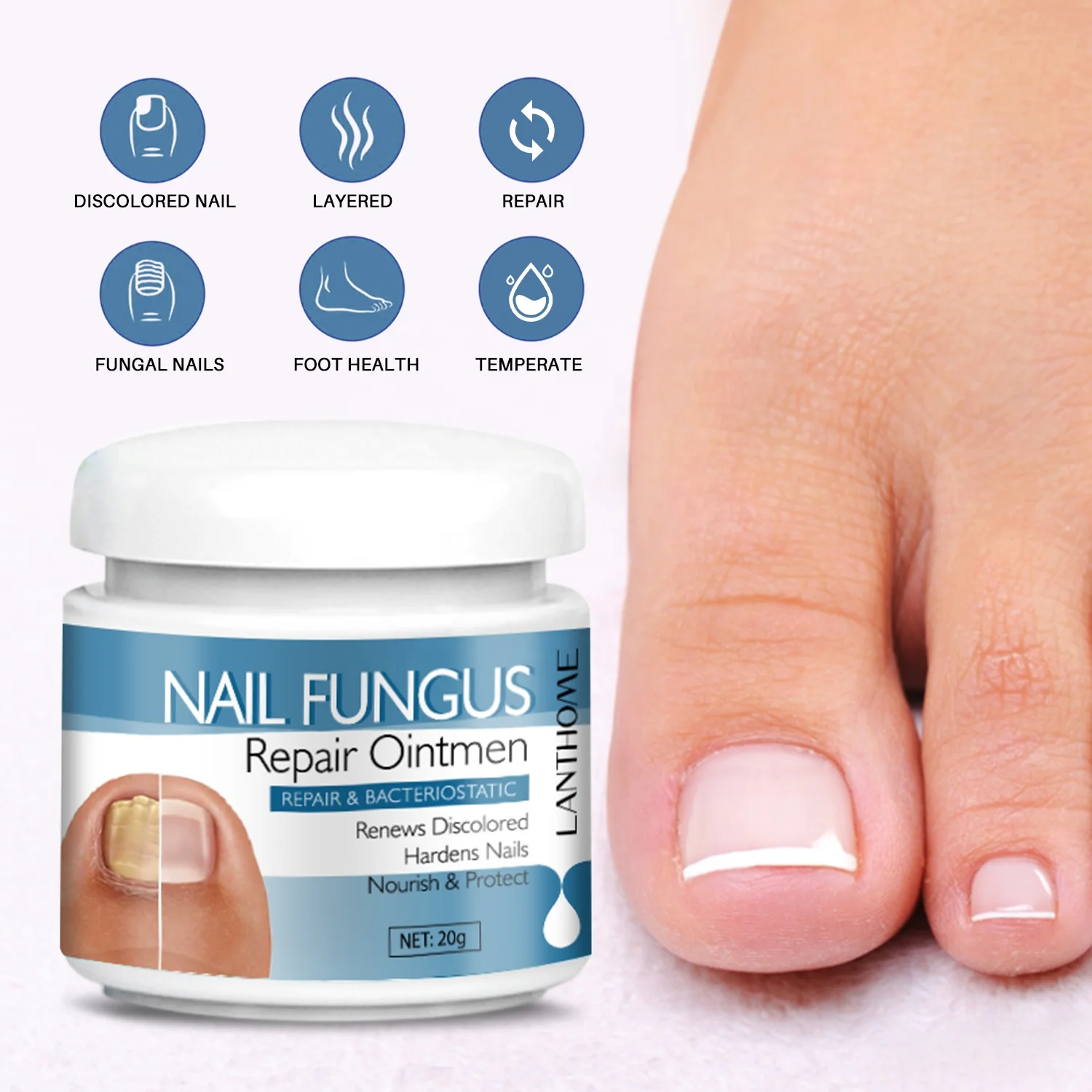 Lanthome Nail Fungus Removal Cream Onychomycosis Fungal Treatment ...