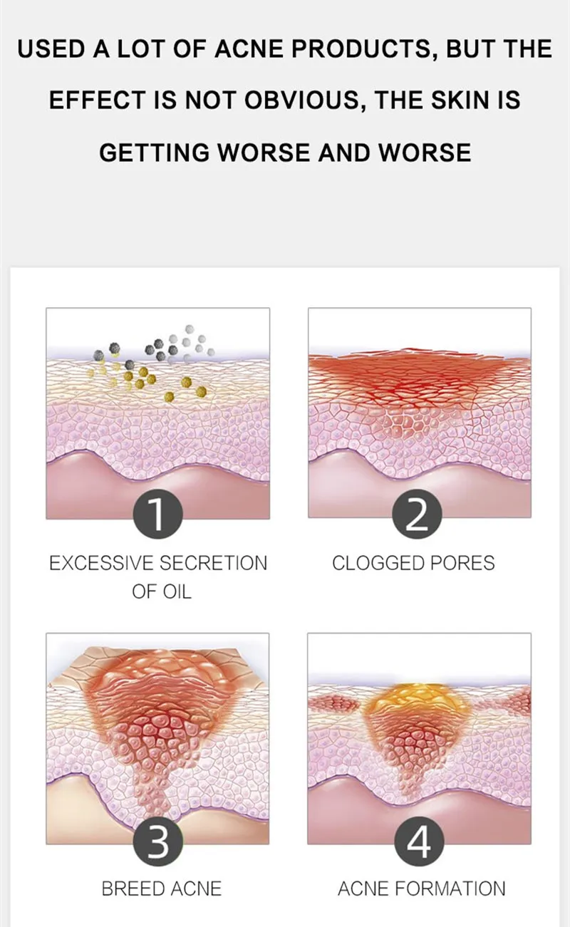 DR.RASHEL aloe vera pimple cream skin natural anti-inflammatory smooth and soft face cream