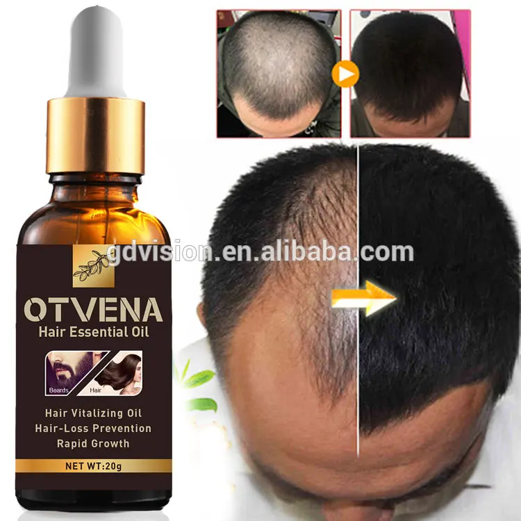 50pcs Oem Hair Spa Lotion Treatment Bottle Bald Regrowth Hair Serum - Buy  Hair Treatment,Hair Serum,Hair Lotion Product on 