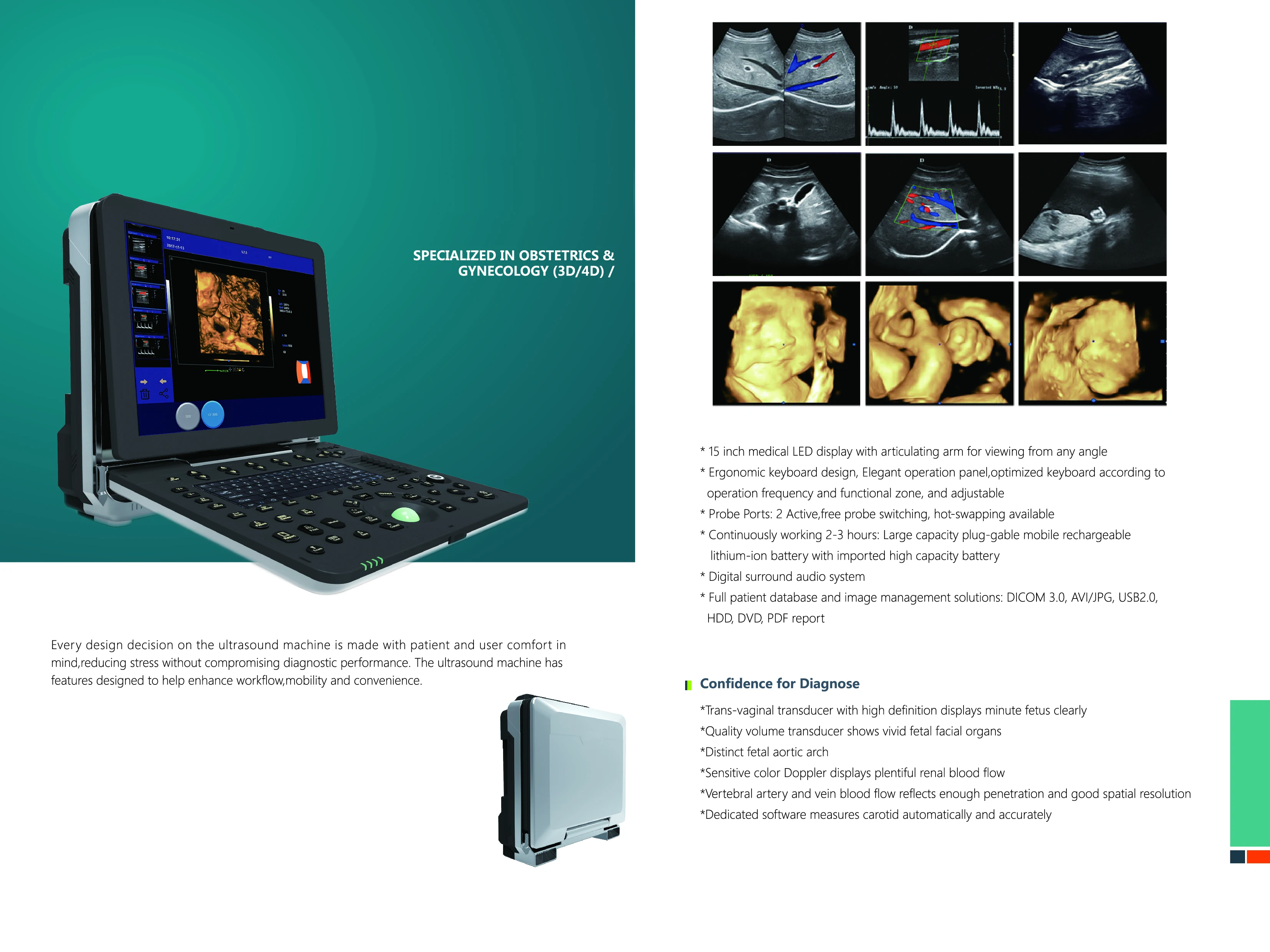 Good Quality Hospital Instrument YSB-P6 Portable Color Ultrasound