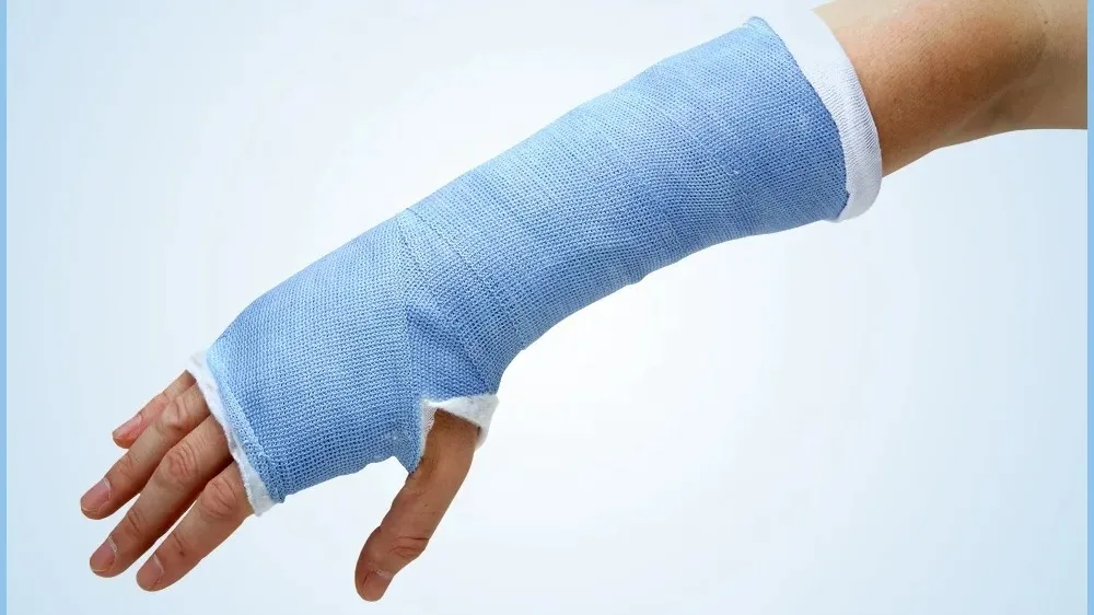 Ansen Brand Oem Waterproof Cast Bandage Orthopedic Fiberglass Casting