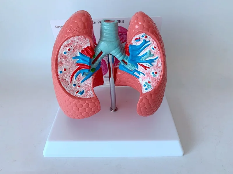 Pathological and Healthy Lung Anatomical Models for Medical Education