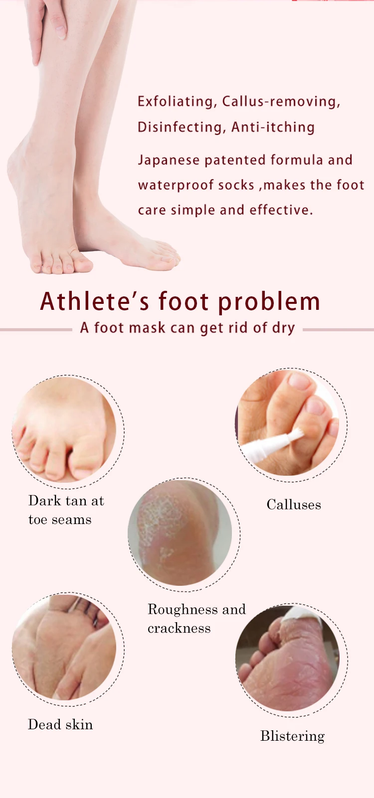 En Kaliteli Oem Sutlu Kore Peeling Peeling Ayak Maskesi Spa Buy Ayak Maskesi Peeling Ayak Maskesi Peeling Peeling Ayak Maskesi Product On Alibaba Com