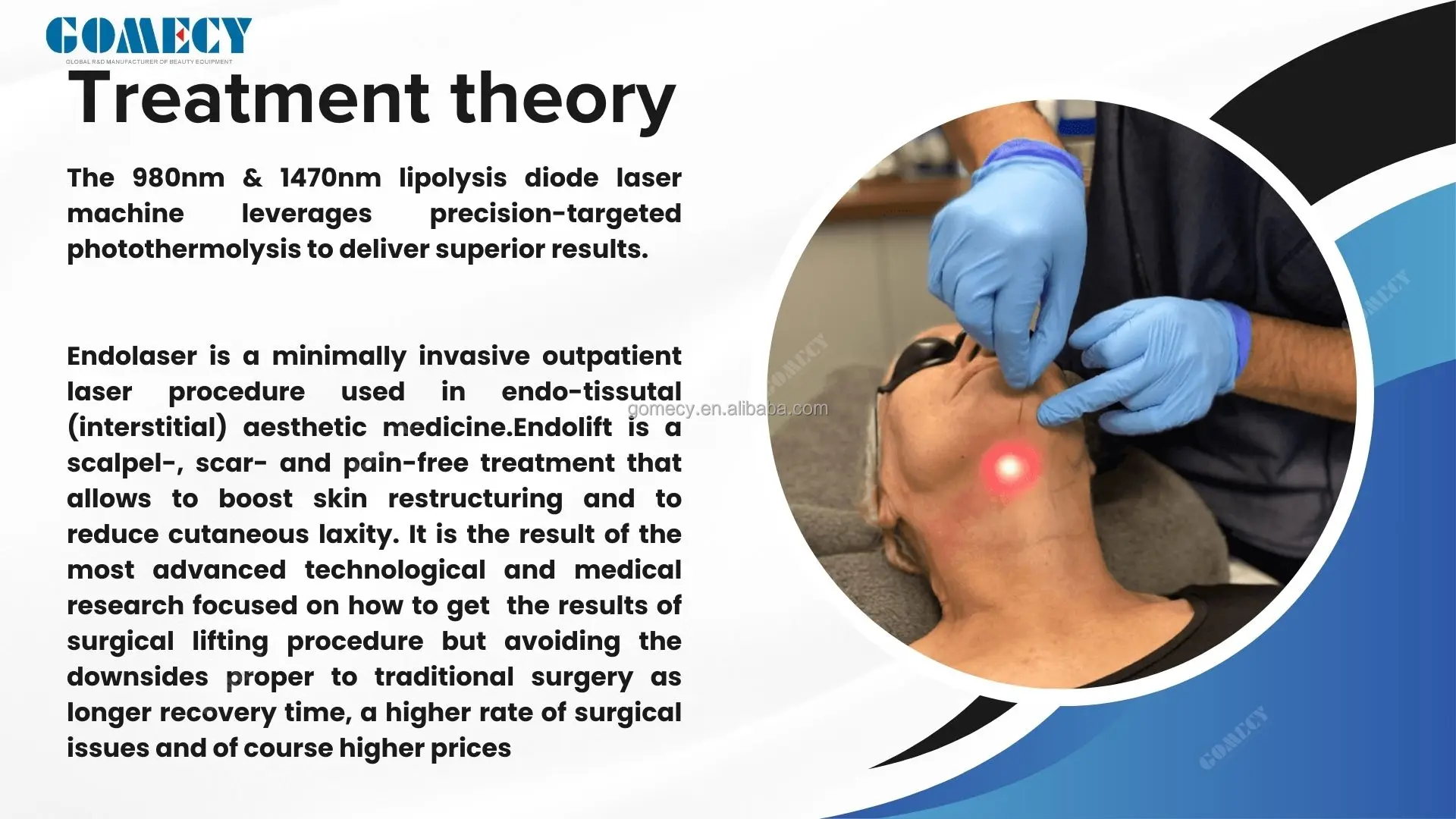 2026 Endolaser Machine Face Lifting Laser 635nm 1470nm 980nm 3 ...