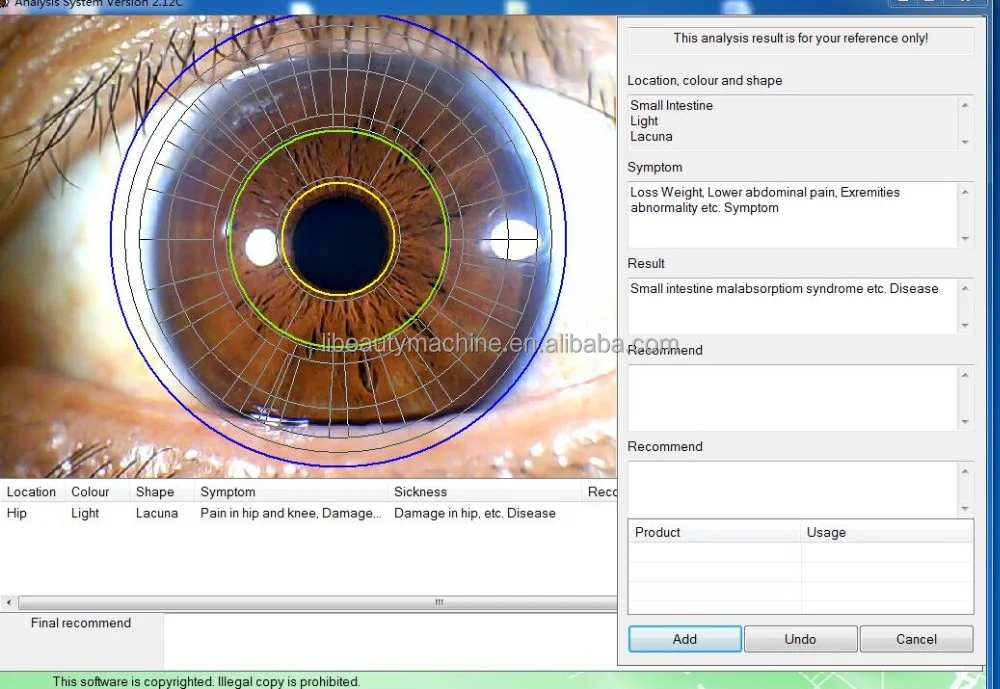 Eye Iridology10