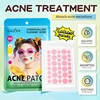 Round pimple patch
