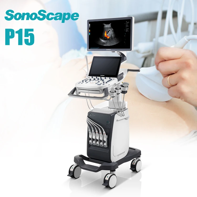 Source 3D/4D Snoscape P15 Diagnostic Color Doppler Ultrasound on  m.alibaba.com