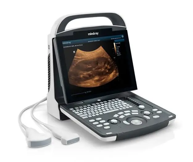 Mindray DP20 Portable Ultrasound Machine Price DP-20