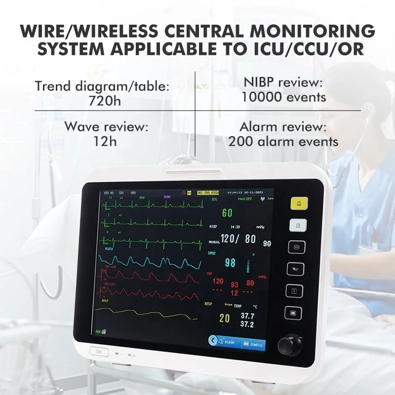 Rayman CE Ambulance Veterinary Multi Parameter Vital Sign Monitoring ...