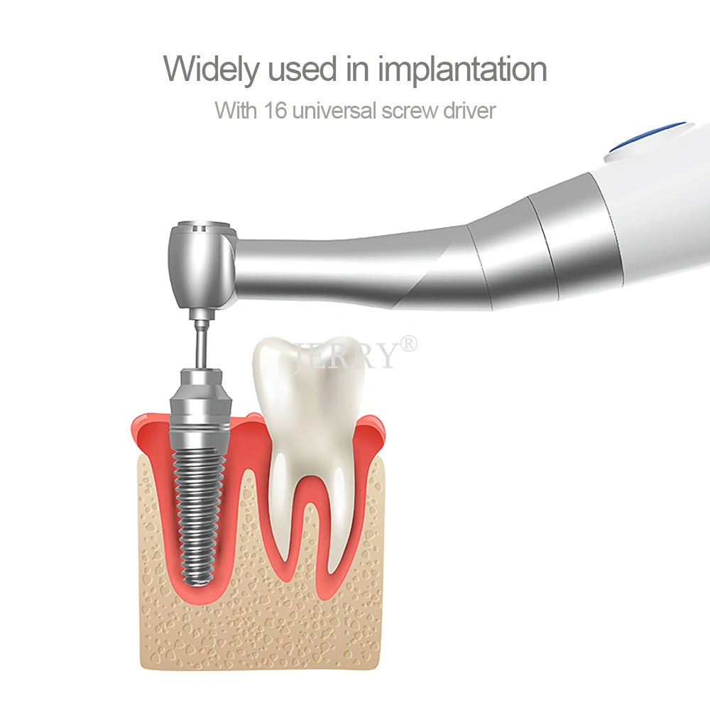 Dental Implant Ratchet & Torque Wrench 1050 Ncm Dental Implant
