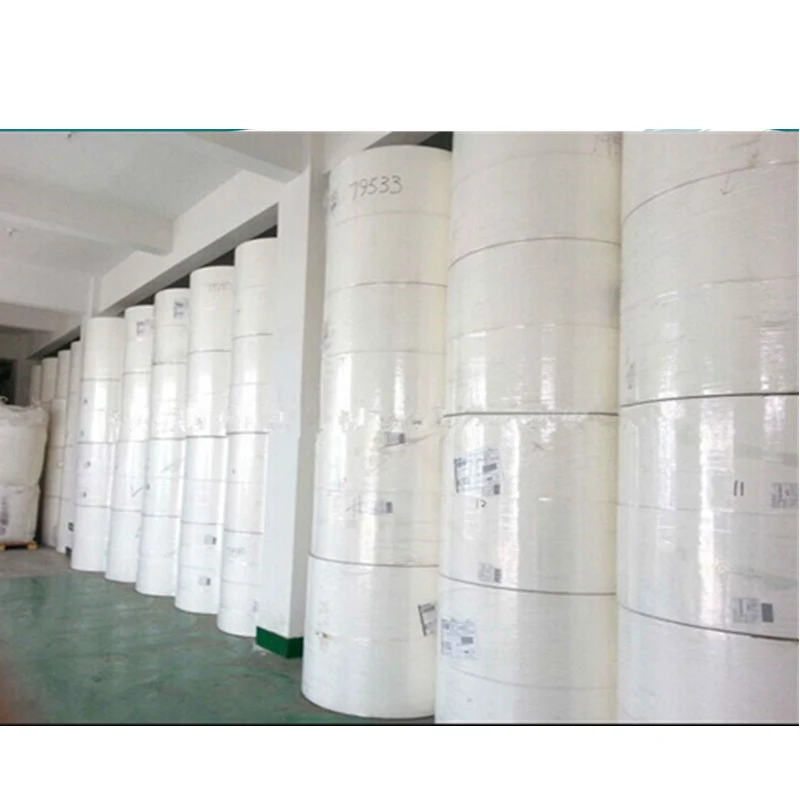 Raw Material Fully Treated Untreated USA Fluff Pulp for Diapers