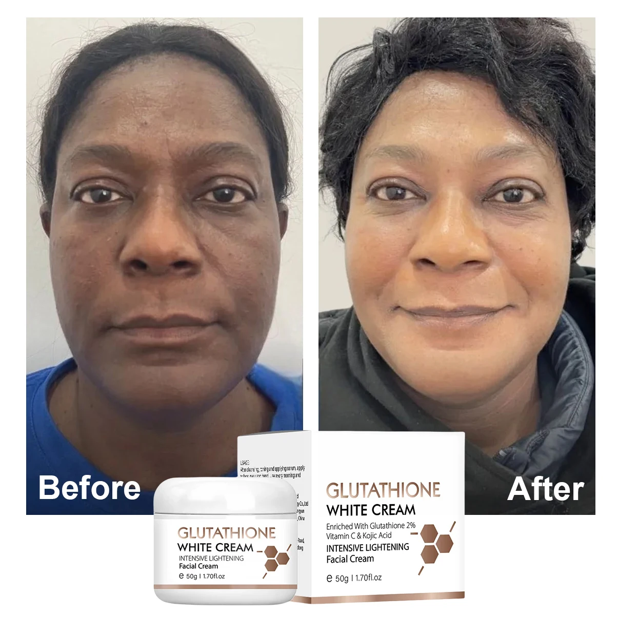 glutathione cream before and after Glutathione Skin Whitening Lightening Bleaching Face Cream Best Whitening  Skin Products for Skin Brightening Black Spots Removal| Alibaba.com