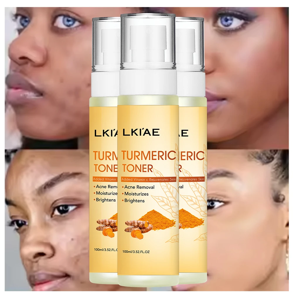 OEM ODM 100% Organic Vitamin C Nicotinamide Hyaluronic Acid Lightening Whitening Anti-Acne Moisturizing Turmeric Facial Toner
