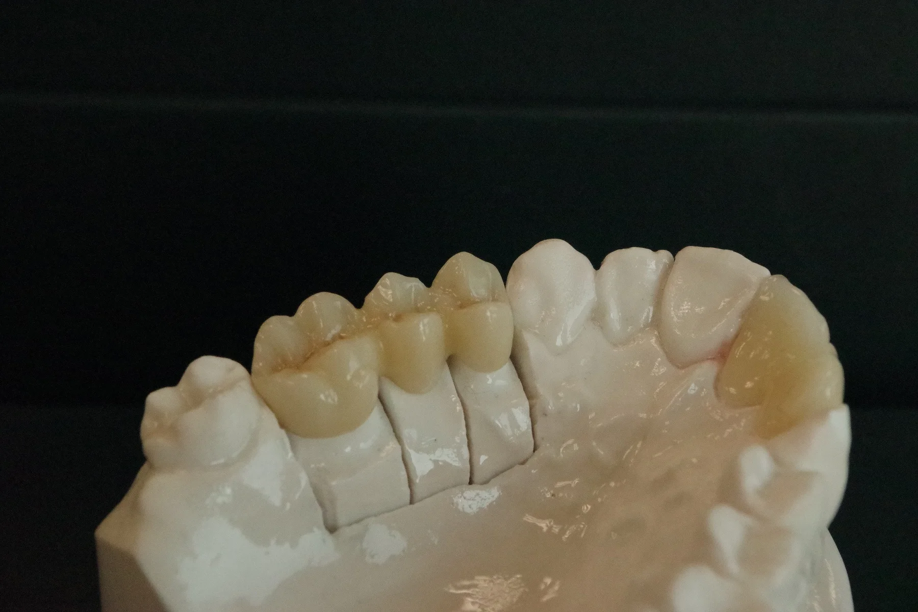 Сколько стоят зубы человека. Циркониевые блоки. Диаторические фарфоровые зубы. Dental Zirconia Ceramics.