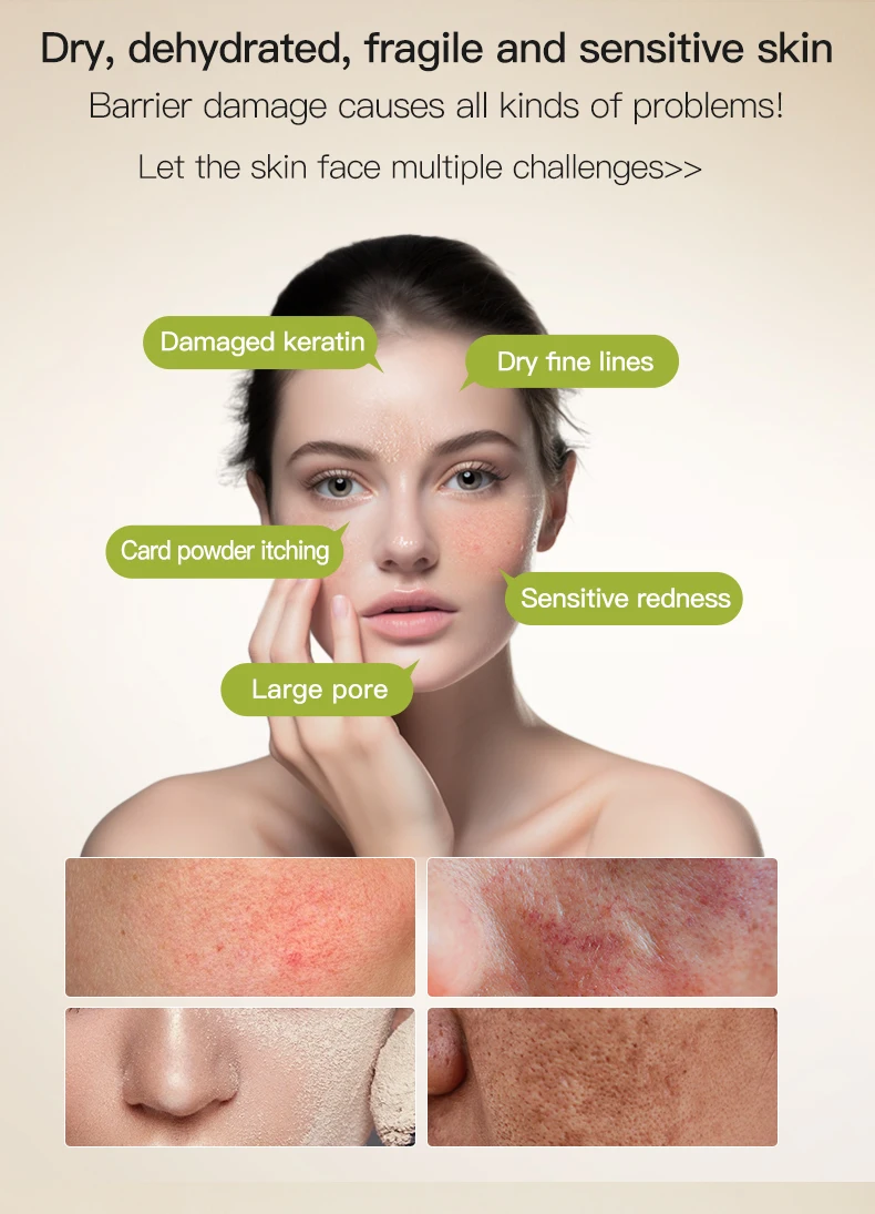 Icesea Chamomile Herbal Soothing Cleanser for Sensitive Skin-Facial Redness Relief & Moisturizing Repair(pic1)