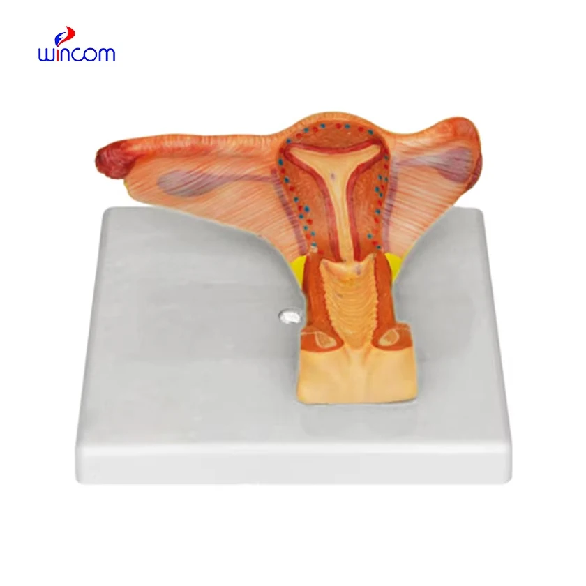 Collapsible Uterus And Vagina Model Wincom Medical Science collapsible-uterus-and-vagina-model-wincom-medical-science