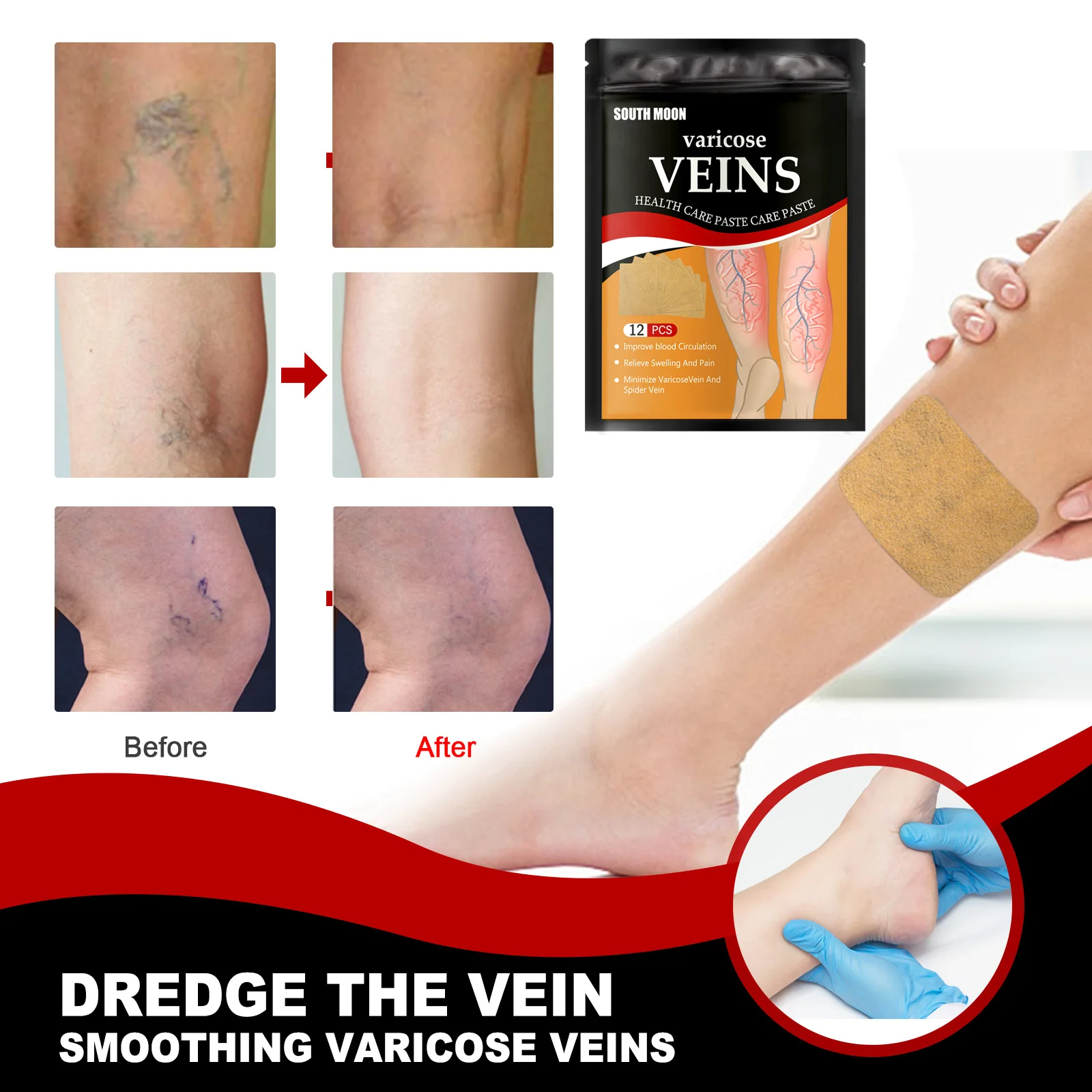 Relief Leg Pain Strengthens Capillary Health Improve Blood Circulation Relieve Swelling And Pain Varicose Veins Patch