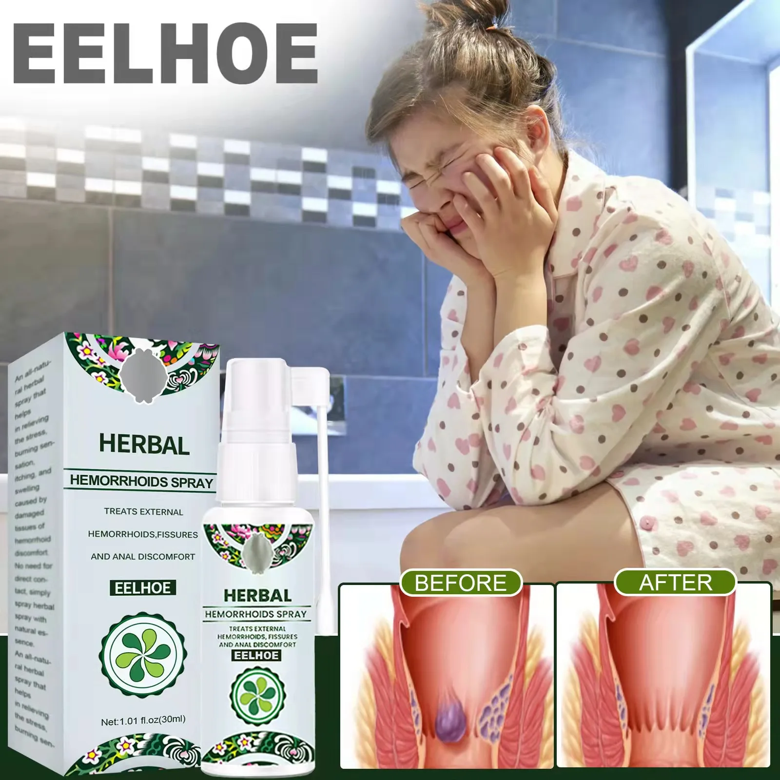 Natural Eelhoe Herbal Hemorrhoid Spray 30ml Hemorrhoids Treatment Buy Hemorrhoids Sprayherbal 