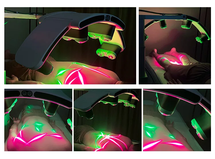 Professional Cold Laser 635nm 532nm Red/Green Light 10D Lipo Slimming Machine Stationary Standing Weight Loss Device