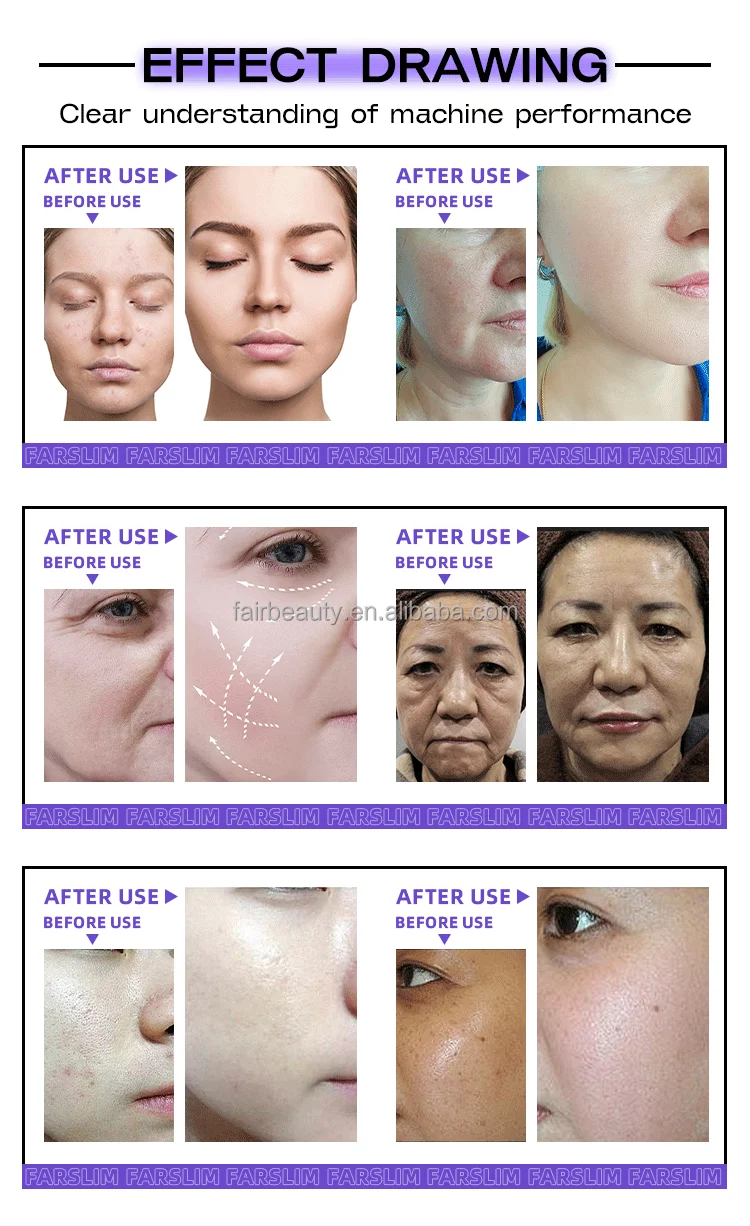 Full Accessory Kit Inventory