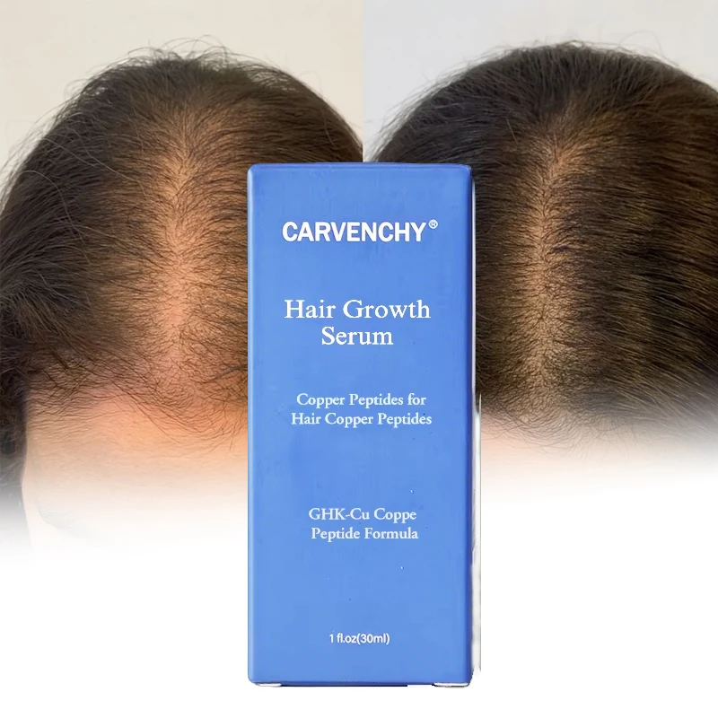 Suero en Gel Avanzado con Péptidos de Cobre Azul GHK-Cu Orgánico para el  Crecimiento del Cabello, Estimula los Folículos, Reduce la Caída y Nutre el  Cuero Cabelludo para Hombres