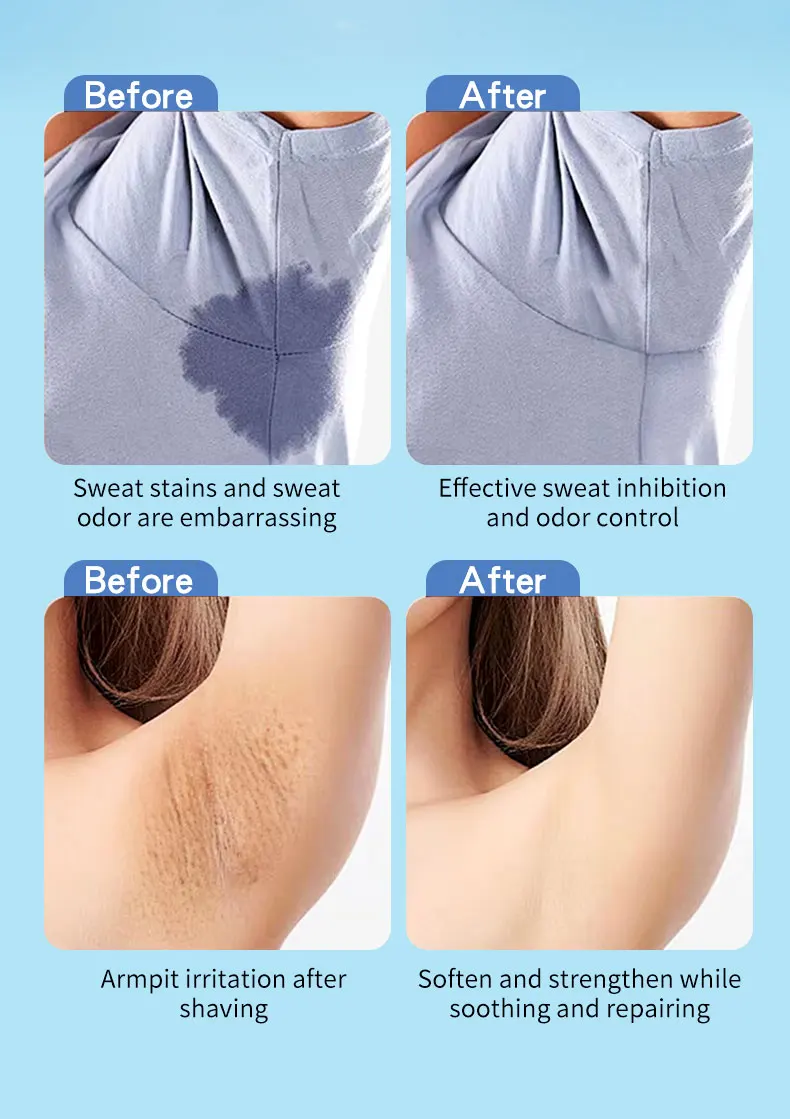 For Herbal Body Underarm Armpit Anti Sweat Odor Removal 48 Hours Long Lasting Refreshing Deodorant Liquid for Unisex