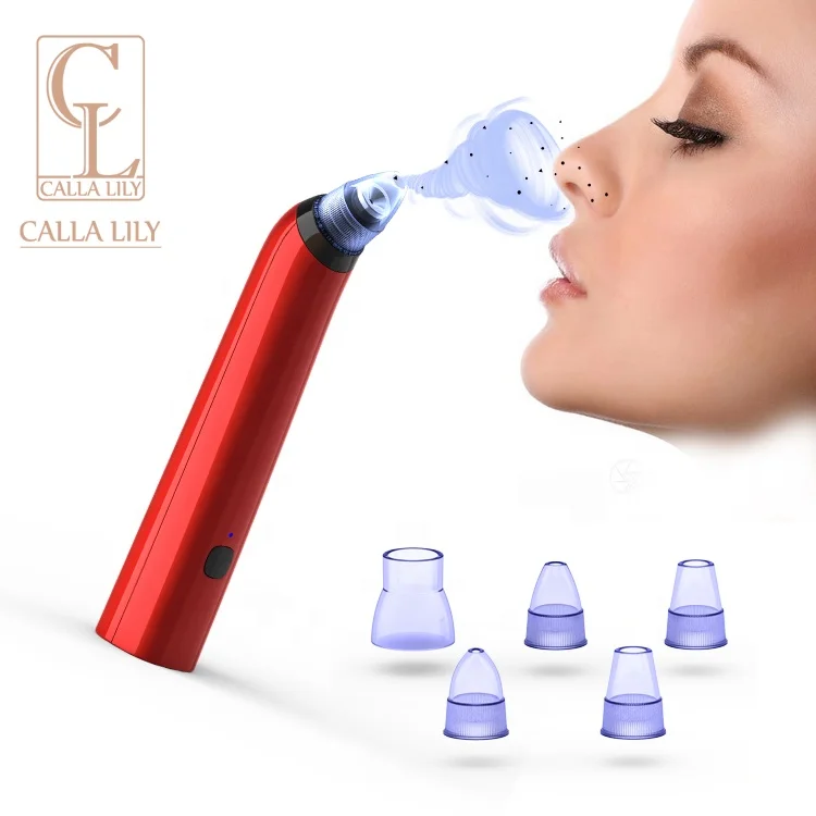 
Легкий способ удаления черных точек на лице, удаление черных точек и белых точек в домашних условиях 