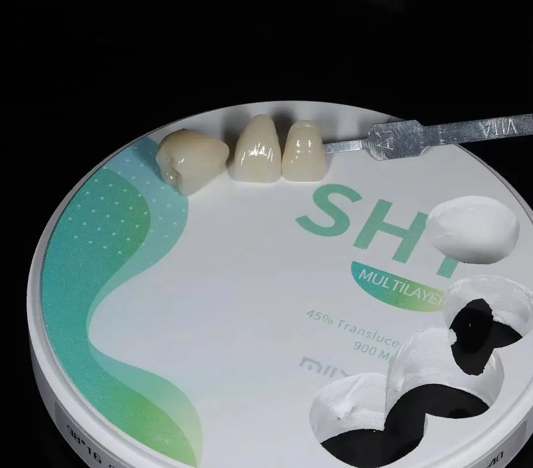 金歯　端材　インレー 金歯 端材 インレー