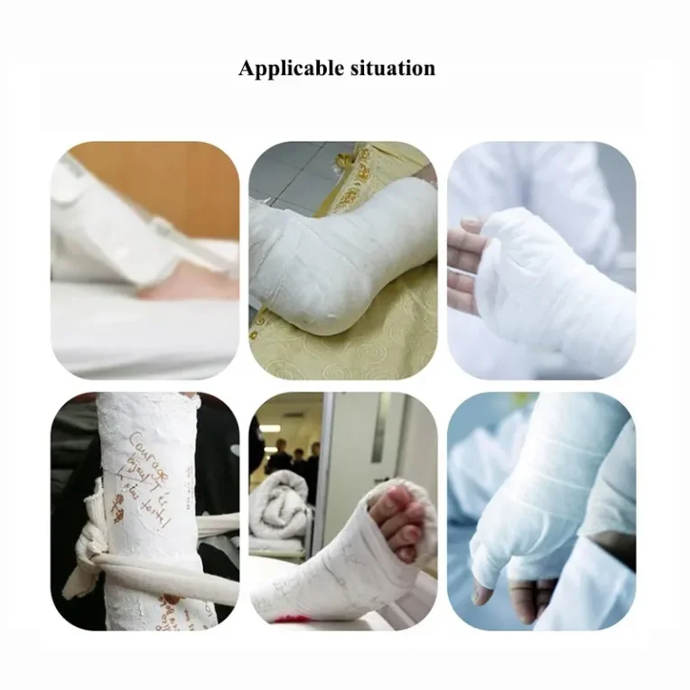 Adhesive undercast padding roll orthopedic cast details