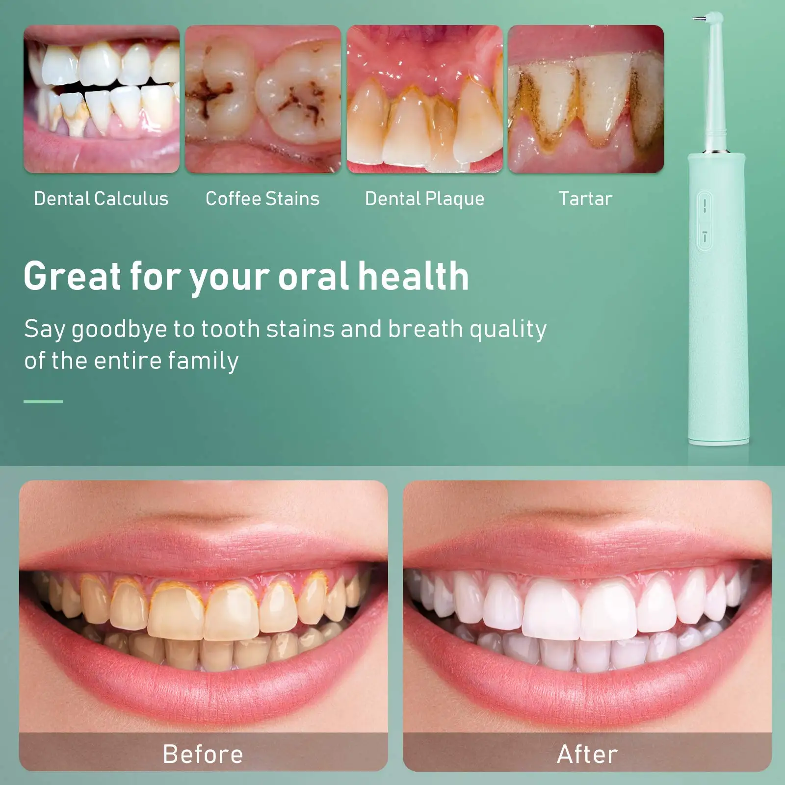 Bigsmile 2021amazon Top Seller Electric Dental Scaler Portable Tooth