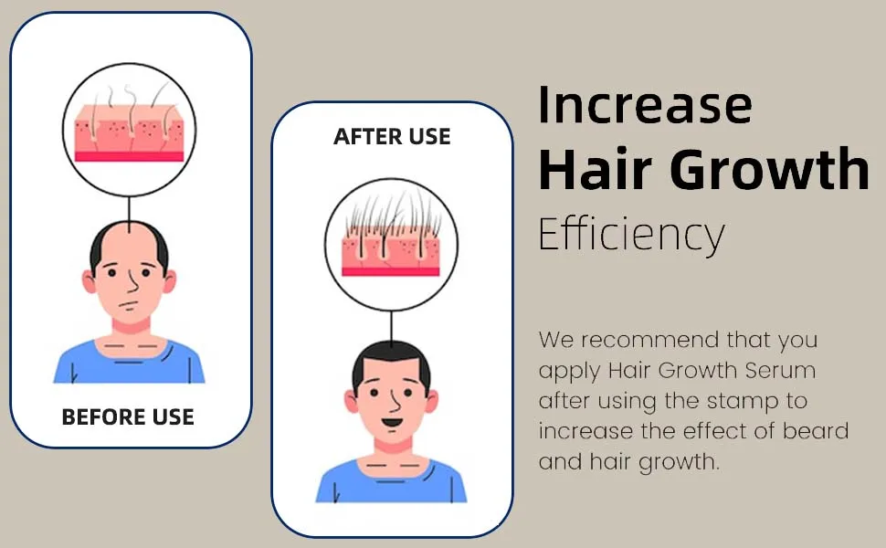 Top Adjustable Derma Stamp Hair Regrowth The Ordinary Hair Care