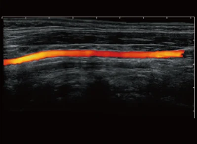 Sonoscape P20 Mobile 3D/4D Real-time Color Panoramic Doppler Trolley Ultrasound Machine details