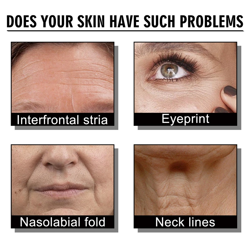 Jaysuing 50ml Firming Skin Cream Interfrontal Stria Eyeprint Nasolabial Fold Neck Lines Improving Face Moisturizing Cream