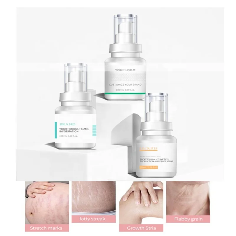 
Частной марки OEM 10 мл 15 мл 30 мл шрамы от акне ремонт глубокий Strech удаление меток сыворотка эссенция для шрамы удалить 