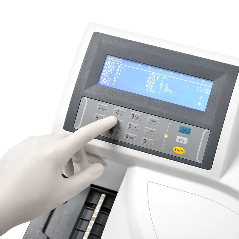 AVE Ave Semi-automatic Urinalysis Machine Clinic Equipment Portable Urine Analyzer