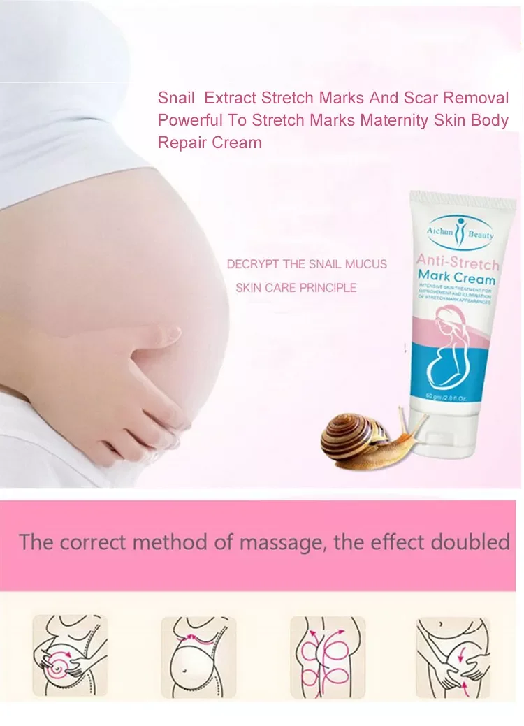 Aichun Beauty Manufacturers Fast Remove Scar Mark Repair Pregnancy Stretch Marks Removal Cream for Women