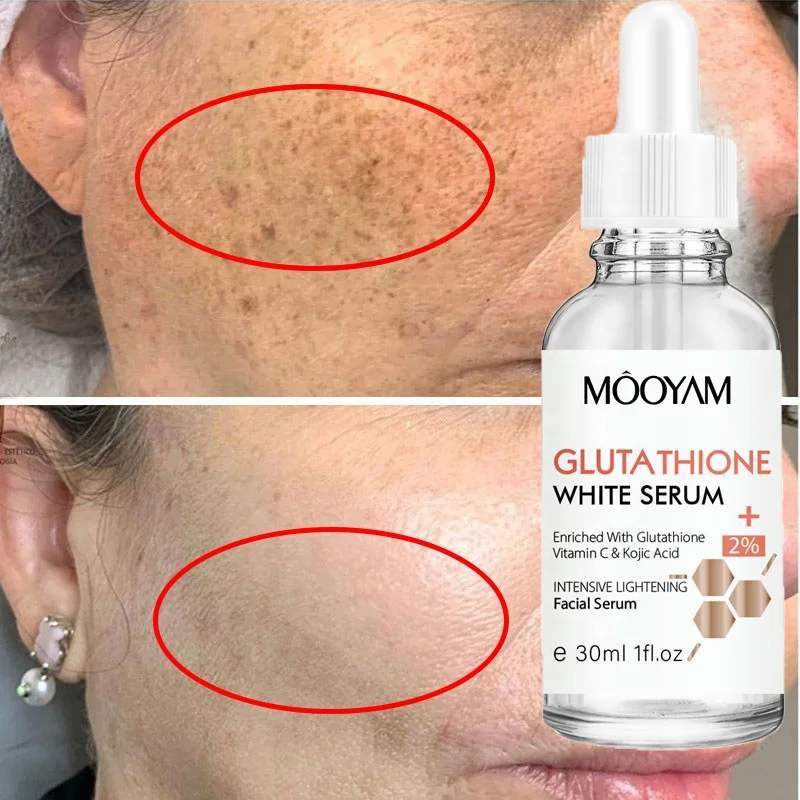 brightening serum- kojic acid & glutathione product info and reviews Private Label Vitamin C Skincare Serum Skin Whitening Facial Serum For Dark Spots Remover Doctor Explains How BPC-157