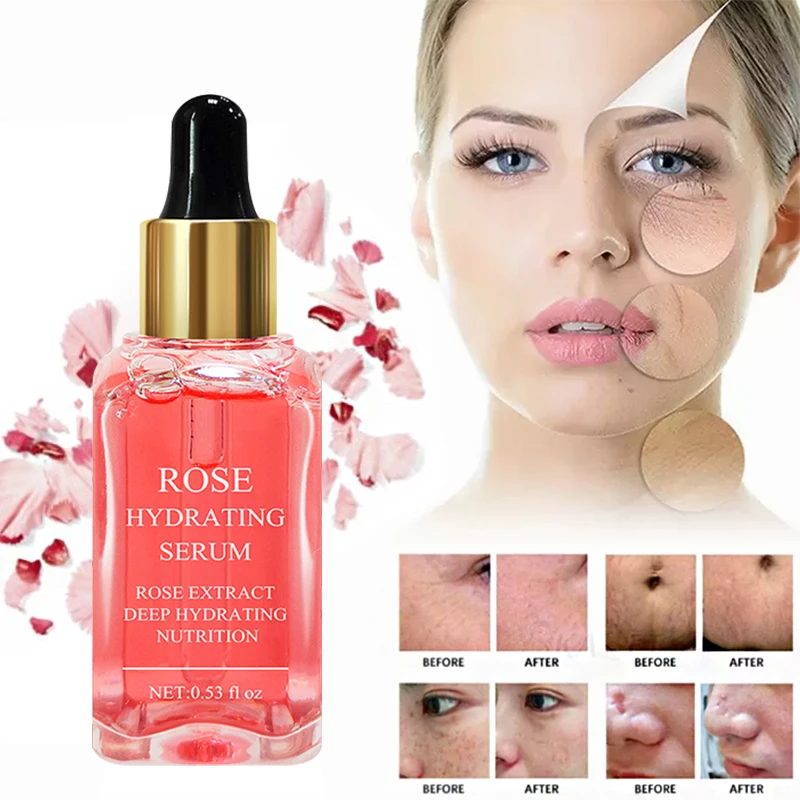 High Quality Niacinamide Collagen Repairing Serum,Lifting Firming Pore ...